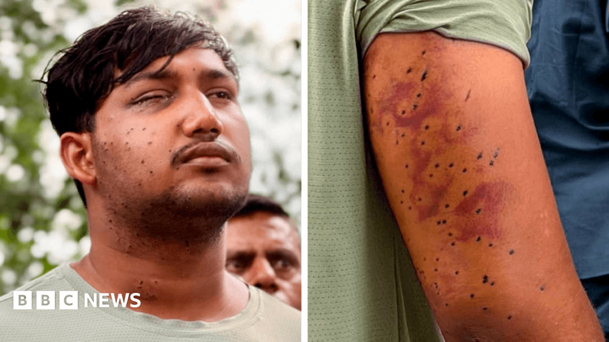 Indian Police Pellet Guns Injure Protesters: Medical Experts Confirm Wounds