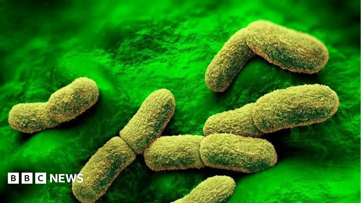 US Monitors Russian Plague Researcher's Death at Siberian Bioweapons Facility