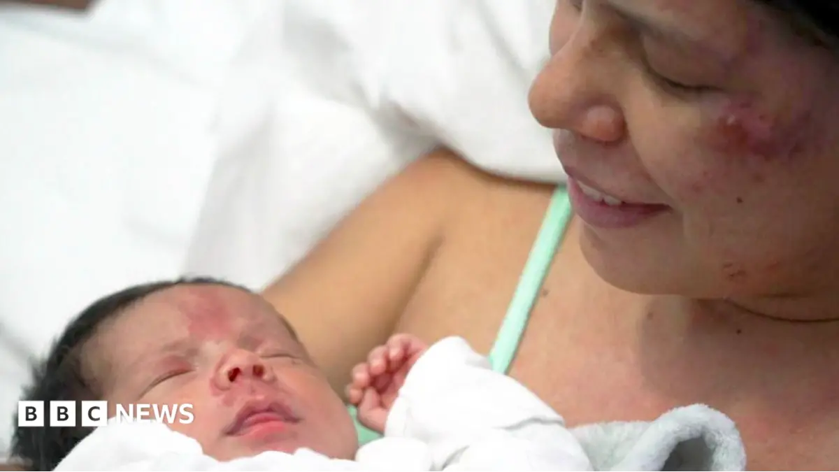 Eighteen-Day-Old Infant Juan David Survives Venezuela Earthquake Rubble Ordeal