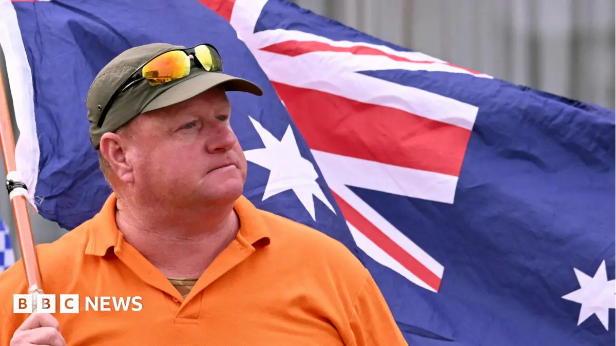 Australian MP Mike Kelly Undergoes Double Amputation After Targeted Attack
