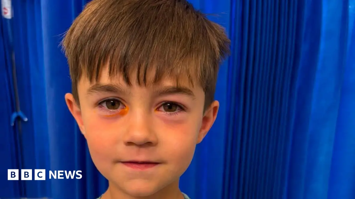 Four-Year-Old Hospitalised as Counterfeit Shein Toy Explodes in Boy's Face