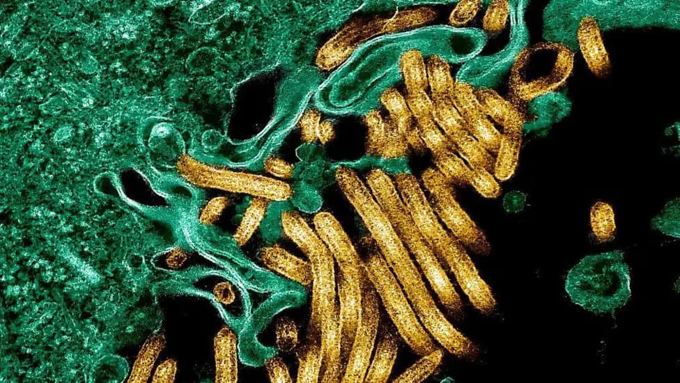 DR Congo: Ebola Kills 65 in Eastern Ituri Province, 246 Cases Reported